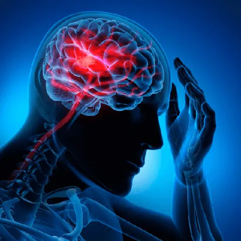 Stroke